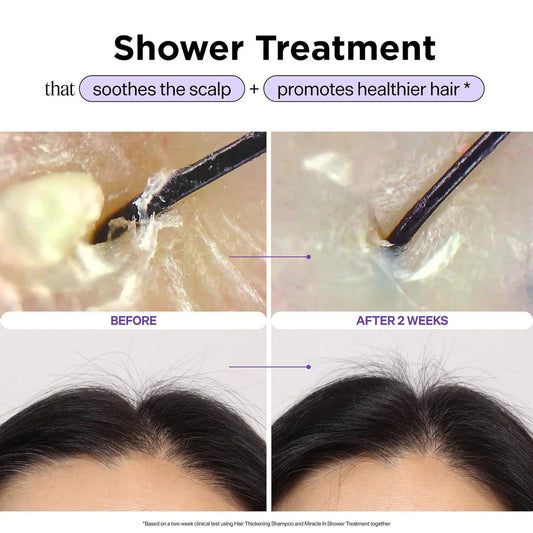 Dr. Groot Miracle In Shower Scalp & Hair Hydrating Treatment for Hair Thinning l Original - The Beauty Code