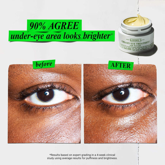 Kiehl's Avocado Eye Cream Duo (2x Full Size)