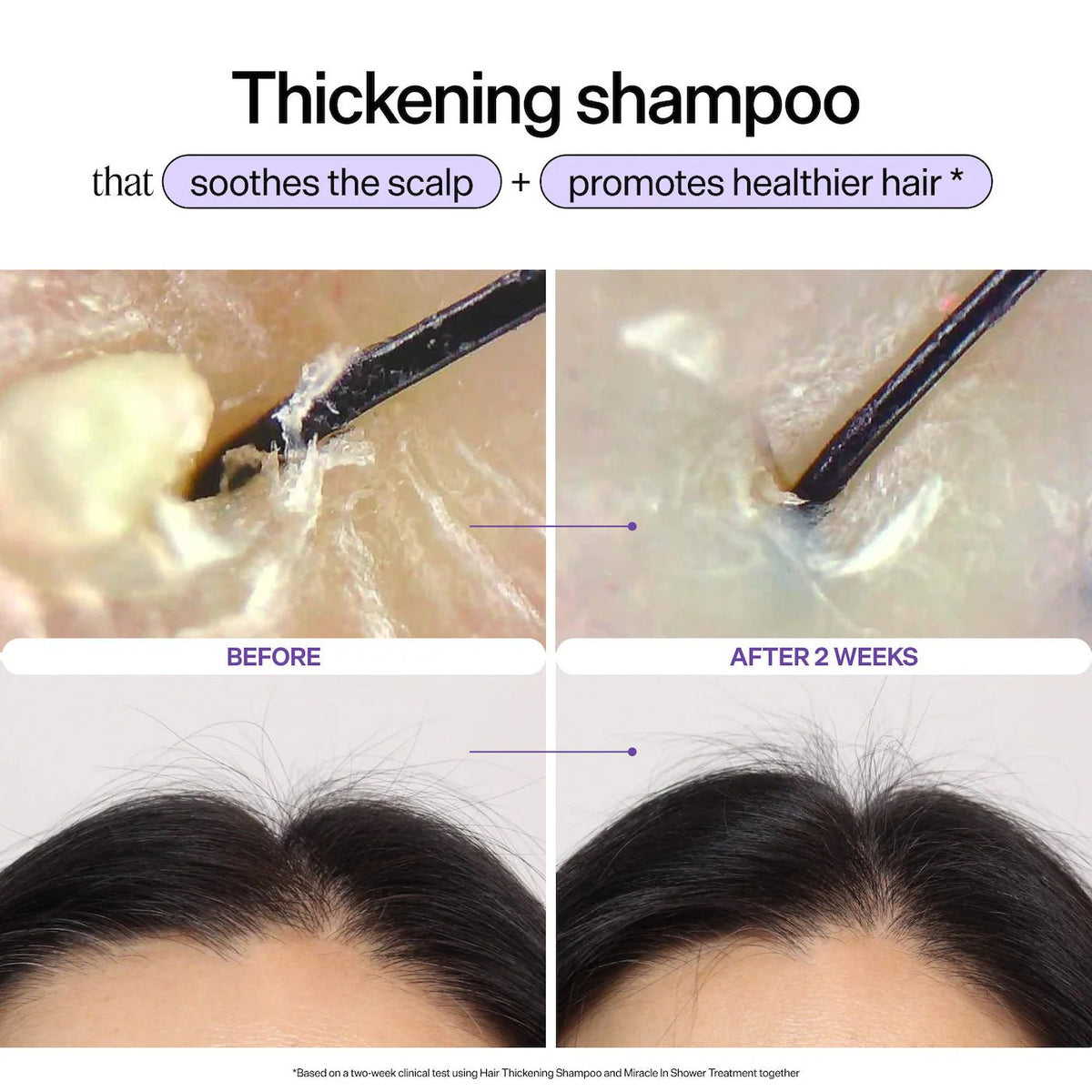 Dr. Groot Genesis Strengthening Scalp and Hair Serum l Original - The Beauty Code