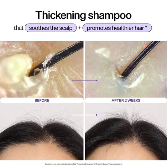Dr. Groot Genesis Strengthening Scalp and Hair Serum l Original - The Beauty Code