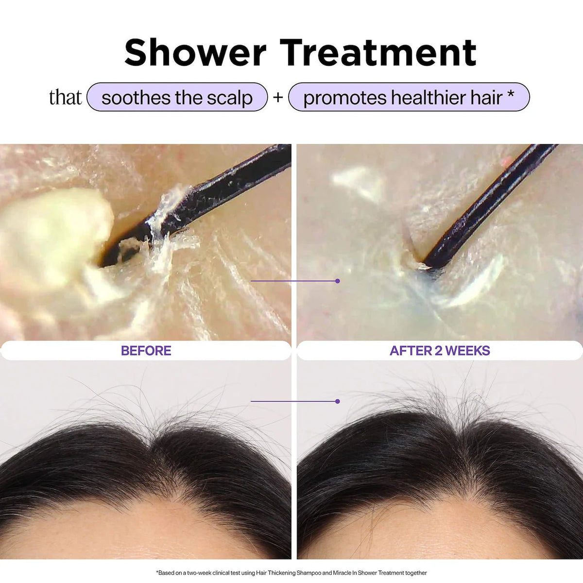 Dr. Groot Miracle In Shower Scalp & Hair Hydrating Treatment for Hair Thinning l Original - The Beauty Code