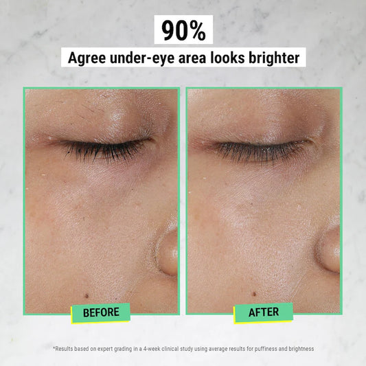 Immediate Kiehl’s Creamy Eye Treatment with Avocado (7 gm)